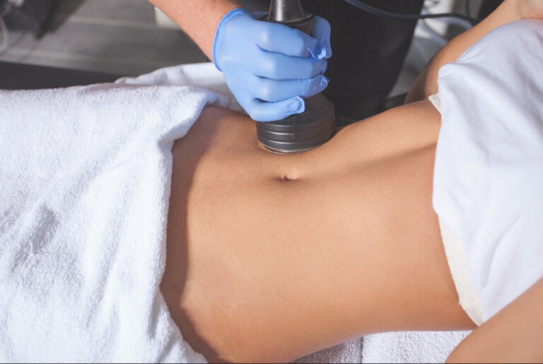 CoolSculpting Before and After Results: Is It Really Worth It?