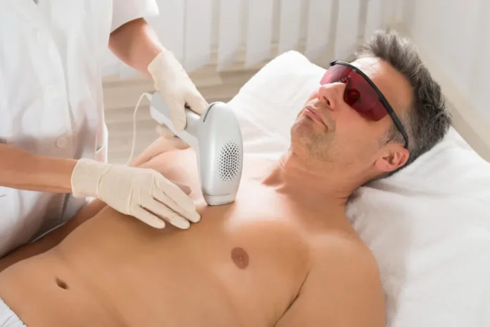 whole body laser hair removal